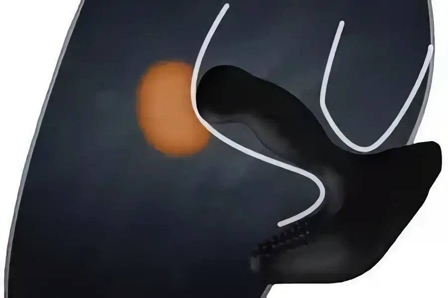 Массаж простаты без секретов – как выполнить для максимального удовольствия?