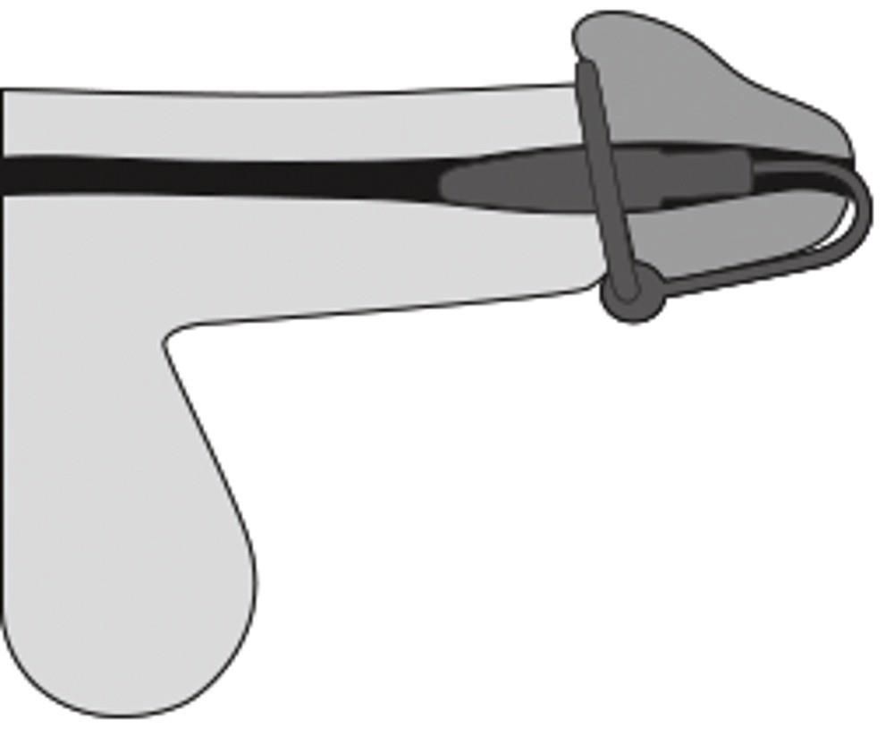 Стимулятор уретри Orion Penis Plug With A Silicone Glans Ring, 4,5 см (сріблястий)