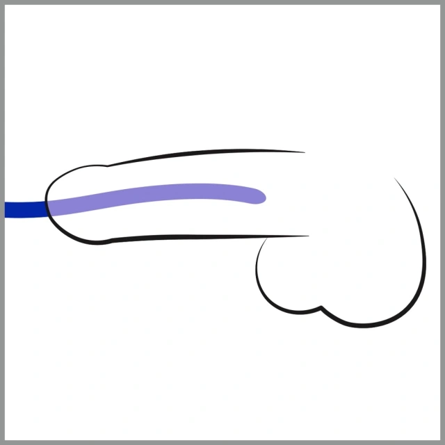 You2Toys Blue Silicone Dilator - Zestaw wkładek cewkowych, Niebieski, 16.5 cm